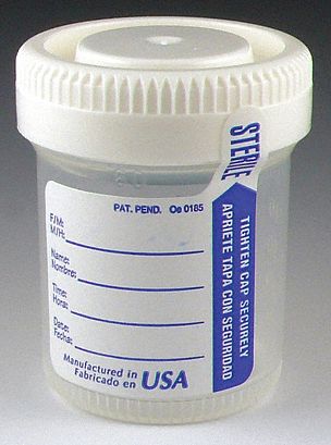 Globe Scientific 3G-OTH-555382